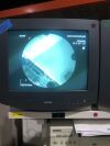 PHILIPS BV Pulsera C-Arm