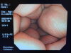 OLYMPUS CF-Q260DI Endoscope