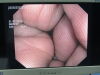 OLYMPUS CF-Q180AL Colonoscope
