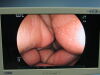 FUJINON EC-450HL5 Colonoscope