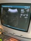 ACUSON 4C1 Ultrasound - Shared Service