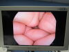 PENTAX EC-3490Fi Colonoscope