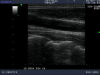 ALOKA UST-5546 Ultrasound Transducer