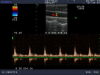 ALOKA UST-5546 Ultrasound Transducer