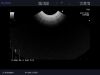 ALOKA UST-9128 Ultrasound Transducer