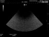 HITACHI S21 Ultrasound Transducer