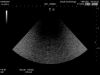 HITACHI S21 Ultrasound Transducer