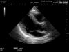 HITACHI S21 Ultrasound Transducer