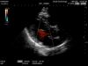 HITACHI S21 Ultrasound Transducer