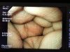 OLYMPUS GIF-H260 Gastroscope