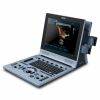 EDAN U60 Ultrasound System