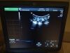 GE C15-d Ultrasound Transducer
