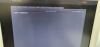 MEDISON Samsung  V20 Prestige Ultrasound - OB / GYN - Vascular