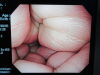 OLYMPUS GIF-PQ260 Gastroscope