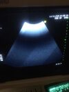GE C364 Ultrasound Transducer
