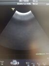 GE AB2-7-RS Ultrasound Transducer