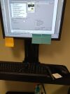 GE Lunar Prodigy Bone Densitometer