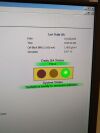 GE Lunar Prodigy Bone Densitometer