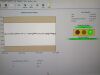 GE Lunar Prodigy Bone Densitometer