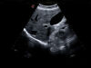 ESAOTE MyLab X7 Ultrasound - Shared Service