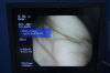 OLYMPUS GIF-Q260 Gastroscope