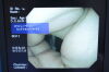 OLYMPUS GIF-H260Z Gastroscope