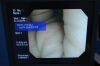 OLYMPUS PCF-Q260AZI Colonoscope