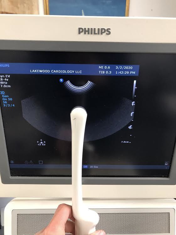 PHILIPS C8-4v (Small Connector) Ultrasound Transducer