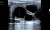 PLUSMED Q20Plus Vet retal linear probe for equine and bovine Vet. Ultrasound