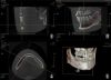VATECH PAX I 3D (PHT-6500) Dental X-Ray