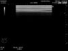 HITACHI L44 Ultrasound Transducer