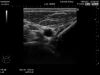 HITACHI L44 Ultrasound Transducer
