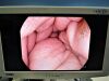 PENTAX EG-2790i Gastroscope