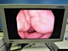 PENTAX EG-2790i Gastroscope