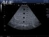 TOSHIBA PVT-382BT Ultrasound Transducer