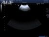 TOSHIBA PVT-382BT Ultrasound Transducer