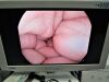 PENTAX EC38-i10M Colonoscope