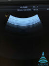 GE 4C-D ultrasound probe repair crystal replacement Ultrasound Transducer