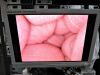 OLYMPUS WA50121A Laparoscope