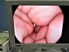 PENTAX EC34i10F Colonoscope