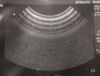 SONOSITE C11e/8-5 MHz Ultrasound Transducer