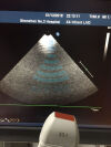 PHILIPS Brand New Original X3-1 Ultrasound Transducer