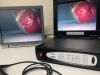 VISION SCIENCES DPU-5050 with CST-5000 Cystoscope