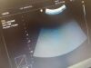 SAMSUNG-MEDISON SC1-6 Ultrasound Transducer