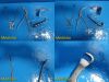 JARIT Complete Professional Lateral Chest Surgical