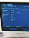 ESAOTE Biosound MYLAB 50 Ultrasound System with LA435 Transducer Probe Ultrasound - Shared Service