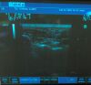 ESAOTE Biosound MYLAB 50 Ultrasound System with LA435 Transducer Probe Ultrasound - Shared Service