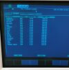 ESAOTE Biosound MYLAB 50 Ultrasound System with LA435 Transducer Probe Ultrasound - Shared Service
