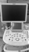 PHILIPS IU22 ULTRASOUND