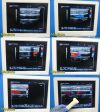 HITACHI EUP-L34T Linear Array Ultrasound Transducer